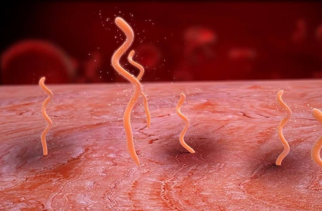 Бактерія борелія — збудник хвороби Лайма, що впливає на нервову, імунну та травну систему людини