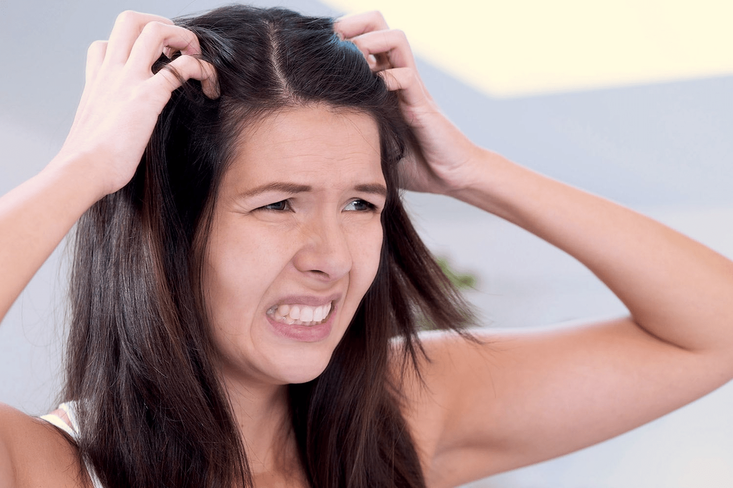 Жінка з свербінням шкіри голови — симптоми себореї або алергії, пов’язані з обміном речовин і травною системою