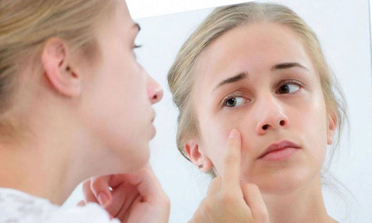 Жінка з подразненням та почервонінням шкіри обличчя, можливі прояви алергії або дерматологічної проблеми