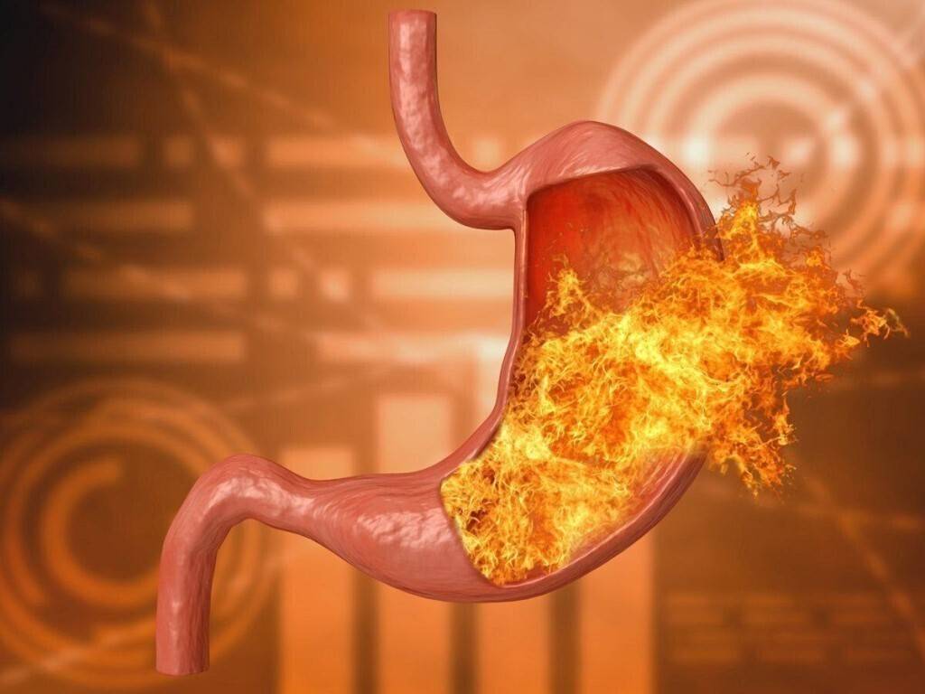 Печія та підвищена кислотність шлунка — подразнення слизової при гастриті та рефлюксі