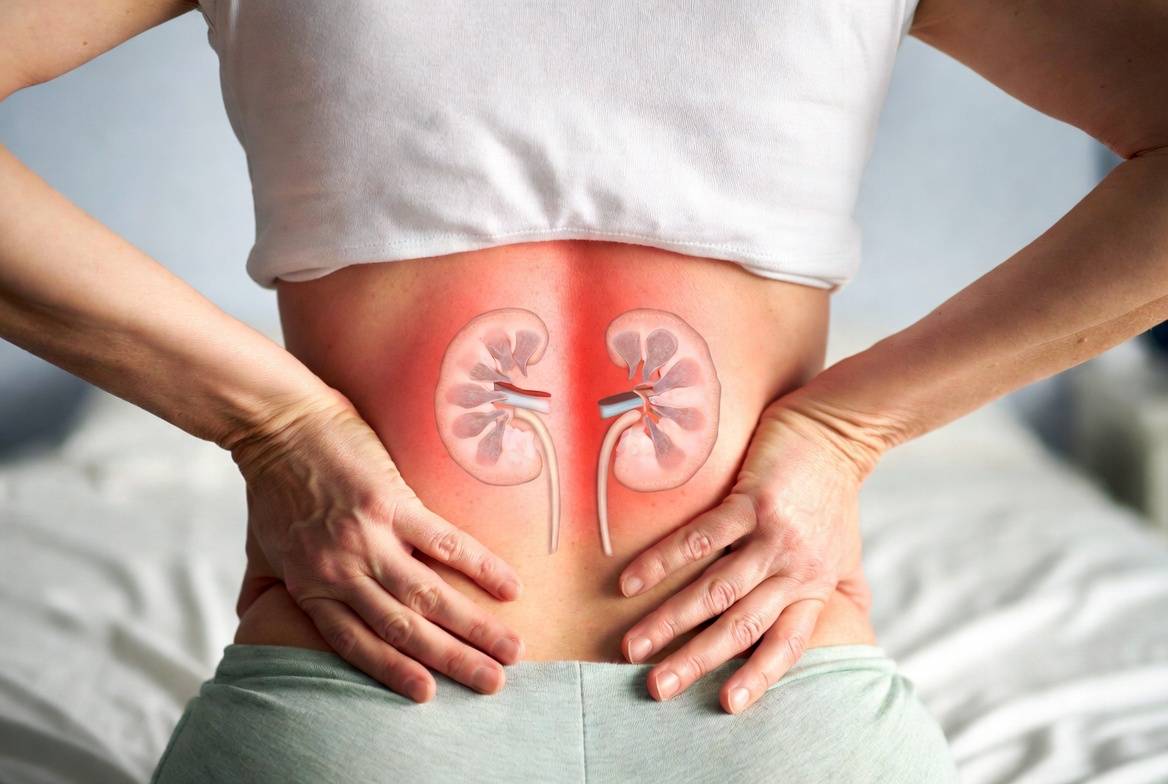 Ниркові коліки