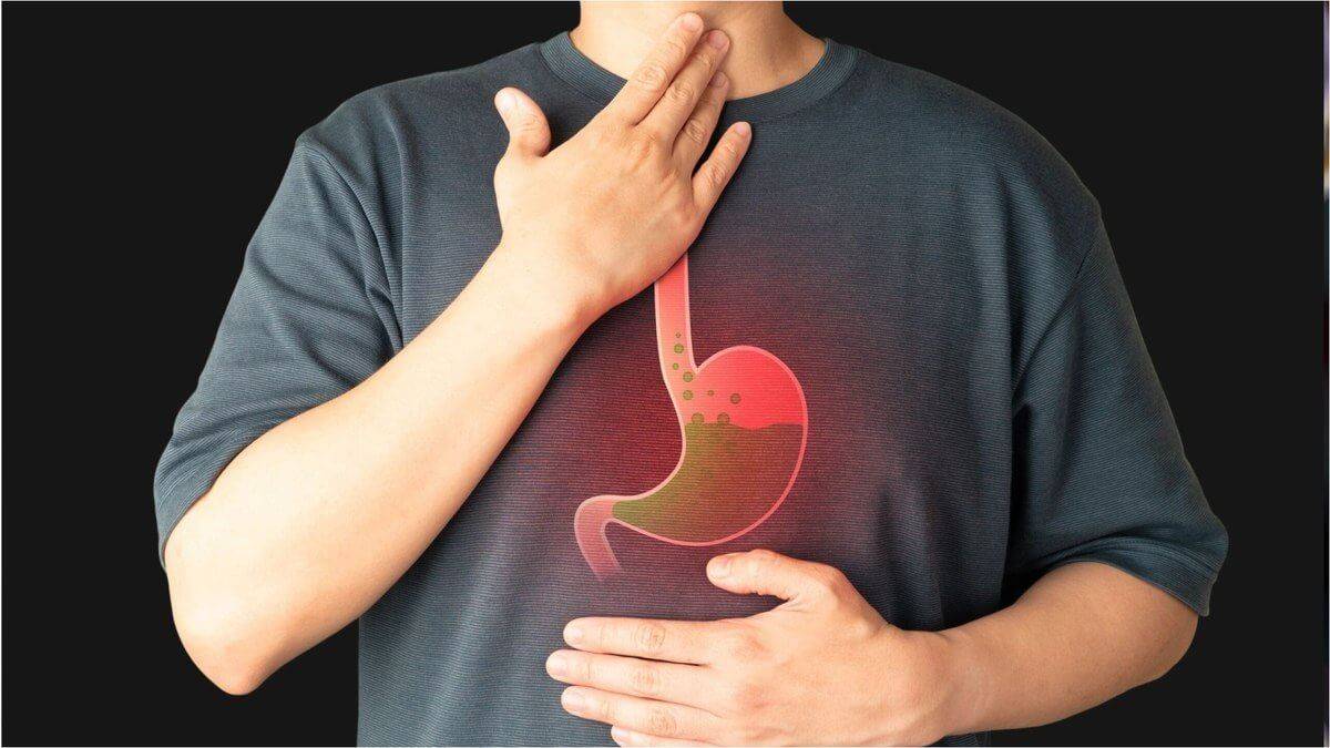 Чоловік тримається за горло і живіт, ілюстрація шлунка з кислотою — відчуття печії.