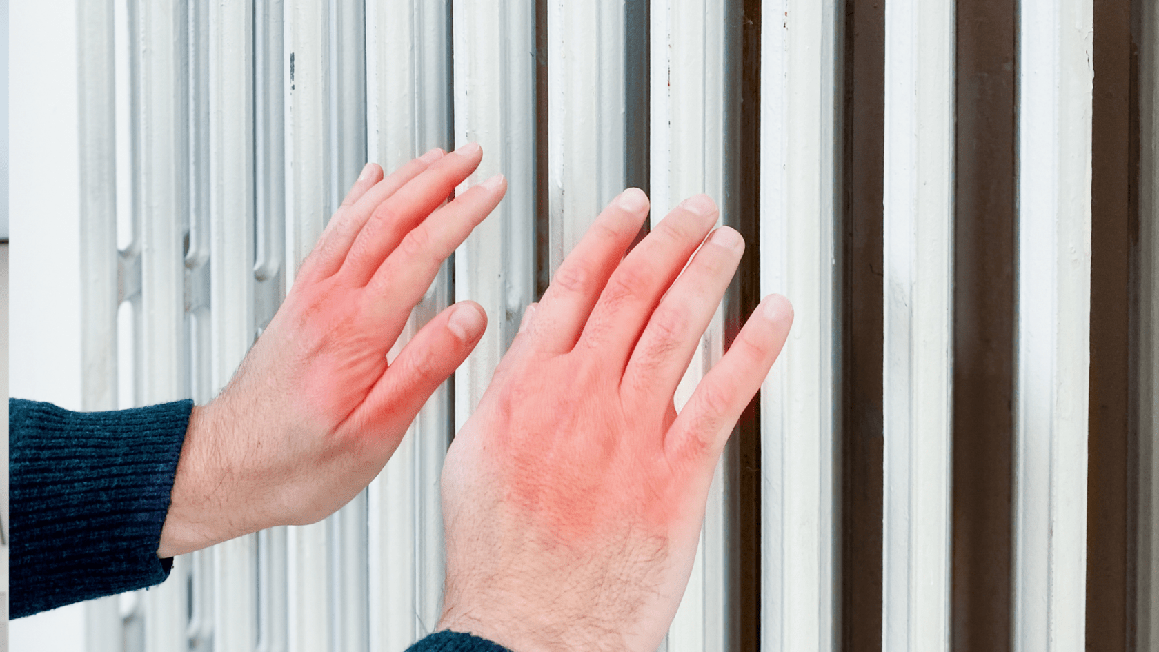 Переохолодження рук – почервоніння шкіри після перебування на холоді та зігрівання біля батареї.