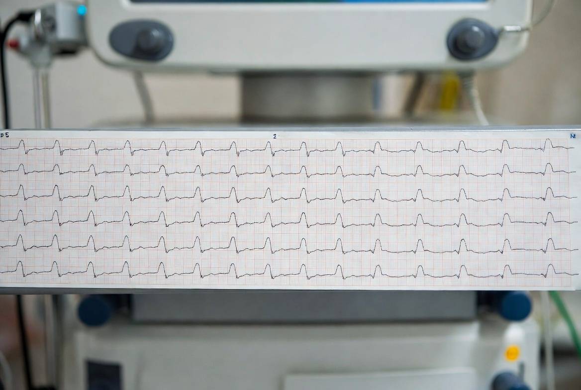 Графічне відображення результатів обстеження