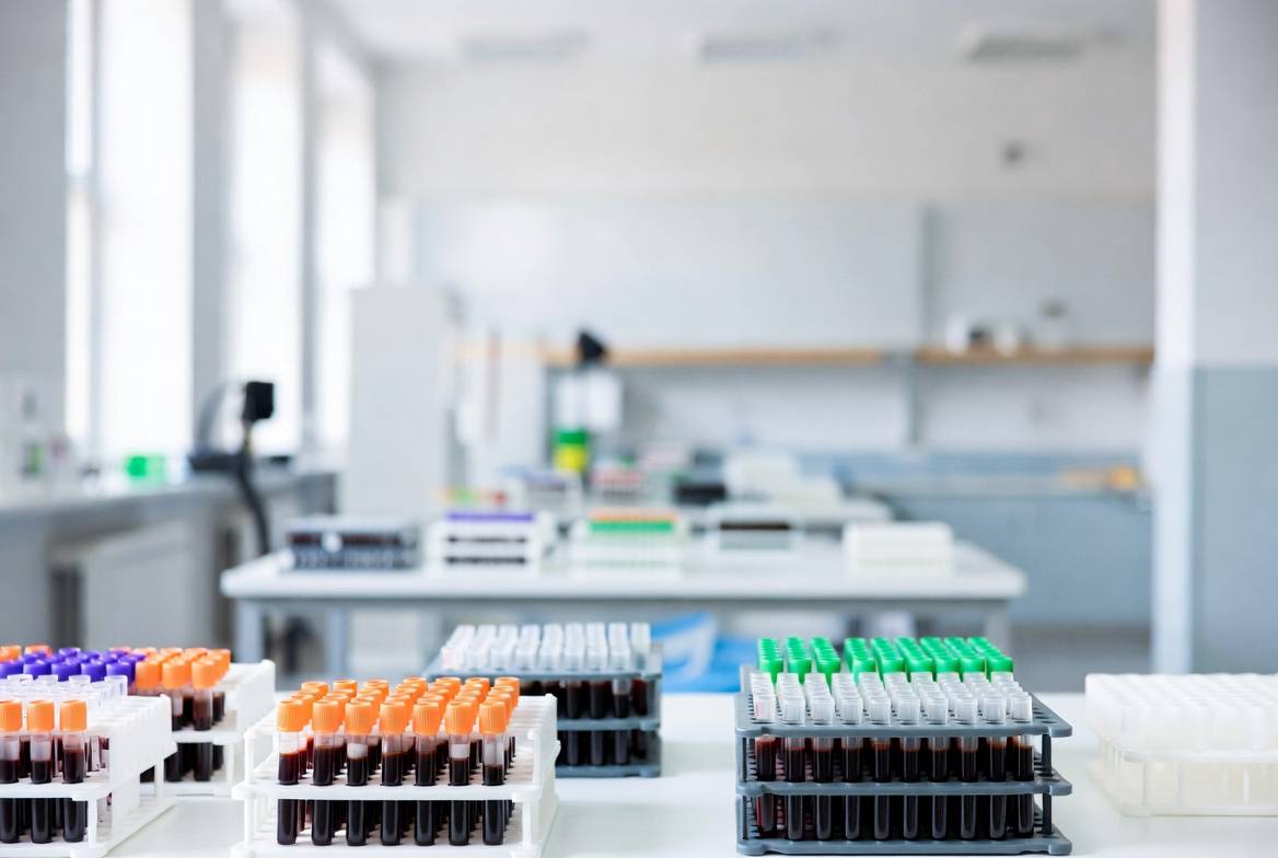 Діагностика вітамінного та гормонального фону