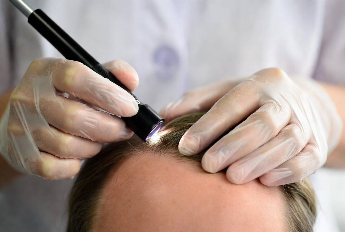 Огляд стану шкіри голови трихологом