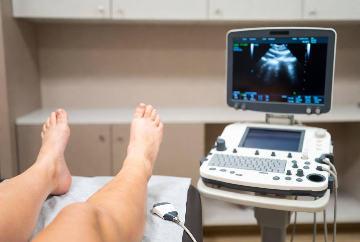 Оцінка стану судин нижніх кінцівок