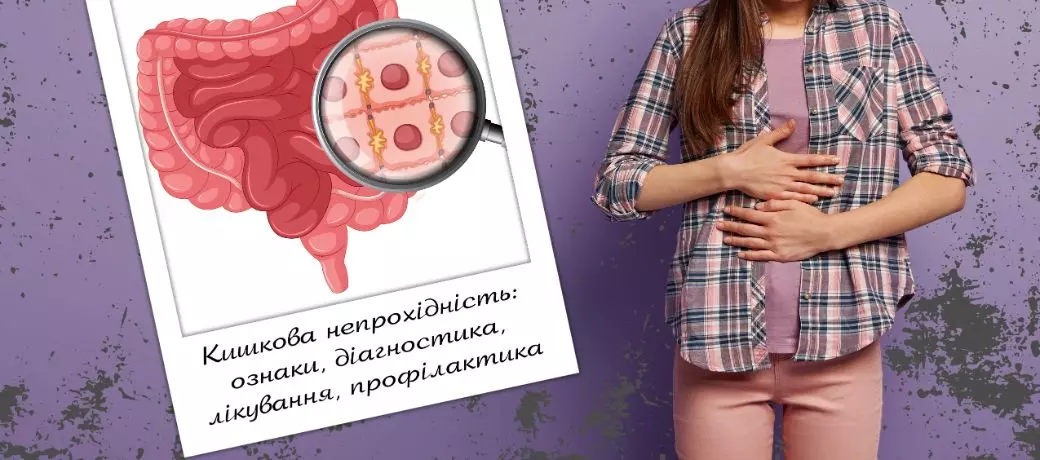 Кишкова непрохідність: симптоми, діагностика та профілактика
