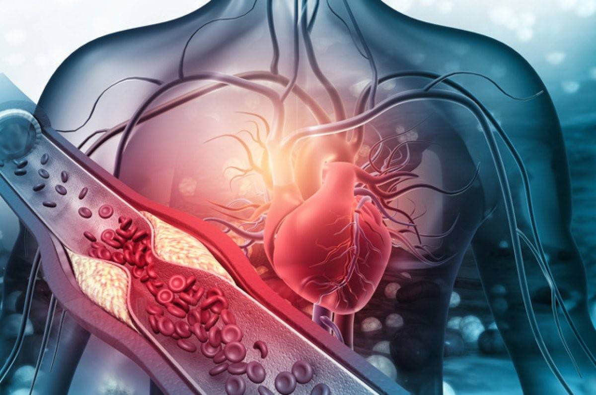 Серце людини та кровоносна судина з ознаками порушення кровообігу, ілюстрація серцево-судинної системи