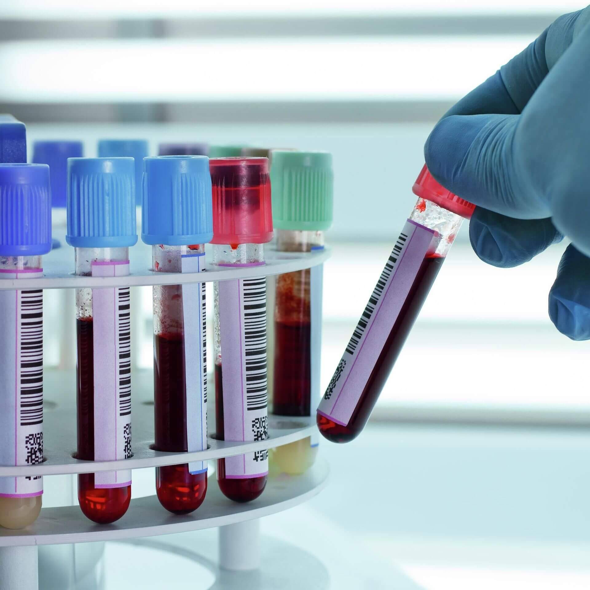Пробірки з кров’ю для лабораторних досліджень на біохімічні показники